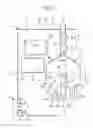 Fig. 02 - Dialysis systems having spiraling fluid air separation chambers