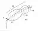 Fig. 01 - Devices and methods for minimally invasive access to sinuses and treatment of sinusitis