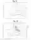Fig. 02 - Devices and methods for minimally invasive access to sinuses and treatment of sinusitis