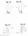 Fig. 06 - Devices and methods for minimally invasive access to sinuses and treatment of sinusitis