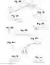 Fig. 08 - Devices and methods for minimally invasive access to sinuses and treatment of sinusitis
