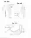 Fig. 28 - Devices and methods for minimally invasive access to sinuses and treatment of sinusitis