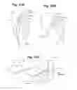 Fig. 32 - Devices and methods for minimally invasive access to sinuses and treatment of sinusitis