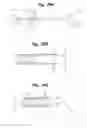 Fig. 37 - Devices and methods for minimally invasive access to sinuses and treatment of sinusitis