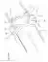 Fig. 35 - Syringe with disabling mechanism