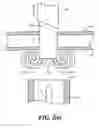 Fig. 06 - Catheter assembly including internal bolster