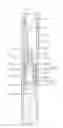 Fig. 01 - SAFETY SYRINGE WITH A NEEDLE RETRACTION DEVICE