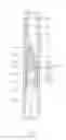 Fig. 05 - SAFETY SYRINGE WITH A NEEDLE RETRACTION DEVICE