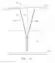 Fig. 04 - System comprising thong-shaped holder and absorbent article