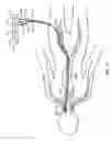 Fig. 07 - Pressure-Sensing Medical Devices, Systems and Methods, and Methods of Forming Medical Devices