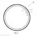 Fig. 04 - Methods for treating hyperopia and presbyopia via laser tunneling