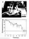 Fig. 07 - Nanosecond pulsed electric fields cause melanomas to self-destruct