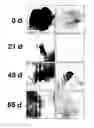 Fig. 08 - Nanosecond pulsed electric fields cause melanomas to self-destruct