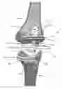 Fig. 01 - Low profile patient specific cutting blocks for a knee joint