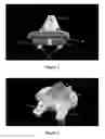 Fig. 03 - Low profile patient specific cutting blocks for a knee joint