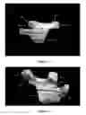 Fig. 04 - Low profile patient specific cutting blocks for a knee joint