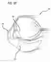 Fig. 06 - Real-time surgical reference indicium apparatus and methods for astigmatism correction