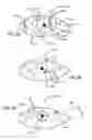 Fig. 07 - Real-time surgical reference indicium apparatus and methods for astigmatism correction