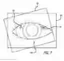 Fig. 08 - Real-time surgical reference indicium apparatus and methods for astigmatism correction
