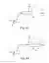 Fig. 09 - FINGER GUIDED SUTURE FIXATION SYSTEM