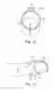 Fig. 13 - FINGER GUIDED SUTURE FIXATION SYSTEM