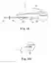 Fig. 06 - Finger guided suture fixation system