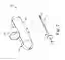 Fig. 07 - Finger guided suture fixation system