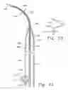 Fig. 03 - Surgical Connection Apparatus and Methods