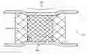 Fig. 01 - STENT-WITHIN-STENT ARRANGEMENTS