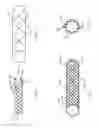 Fig. 02 - STENT-WITHIN-STENT ARRANGEMENTS