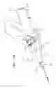 Fig. 67 - Centering of delivery devices with respect to a septal defect