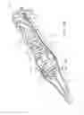 Fig. 68 - Centering of delivery devices with respect to a septal defect