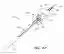 Fig. 95 - Centering of delivery devices with respect to a septal defect