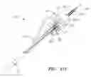 Fig. 97 - Centering of delivery devices with respect to a septal defect