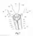 Fig. 06 - OTOMY CLOSURE DEVICE