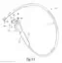 Fig. 12 - OTOMY CLOSURE DEVICE