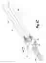 Fig. 04 - Spinal implant with a flexible extension element