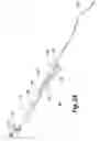 Fig. 07 - Spinal implant with a flexible extension element