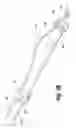 Fig. 08 - Spinal implant with a flexible extension element