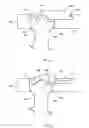 Fig. 09 - Spinal plate with compression locking