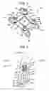 Fig. 02 - Method and plate for fusing the medial column bones of the foot