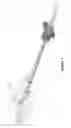 Fig. 06 - Method and apparatus for bone removal