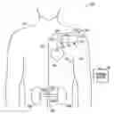 Fig. 01 - METHOD AND APPARATUS FOR CARDIORENAL ELECTRICAL STIMULATION