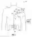 Fig. 02 - METHOD AND APPARATUS FOR CARDIORENAL ELECTRICAL STIMULATION