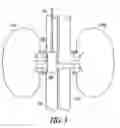 Fig. 04 - METHOD AND APPARATUS FOR CARDIORENAL ELECTRICAL STIMULATION