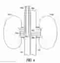 Fig. 05 - METHOD AND APPARATUS FOR CARDIORENAL ELECTRICAL STIMULATION