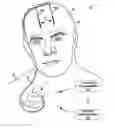 Fig. 01 - Managing electrical stimulation therapy based on variable electrode combinations