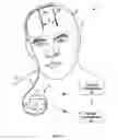 Fig. 02 - Managing electrical stimulation therapy based on variable electrode combinations