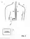 Fig. 03 - Managing electrical stimulation therapy based on variable electrode combinations