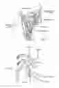 Fig. 14 - Systems and methods for maintaining airway patency